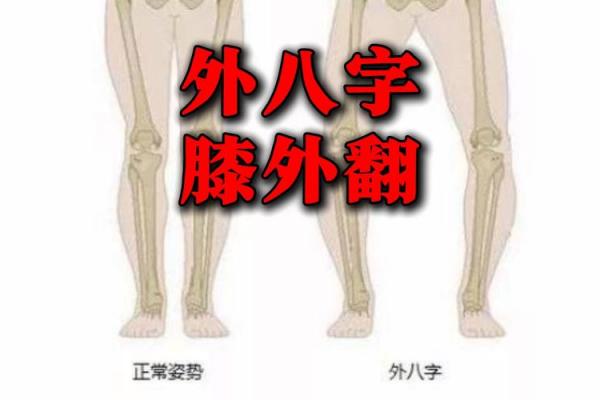 八字型腿 八字型腿
