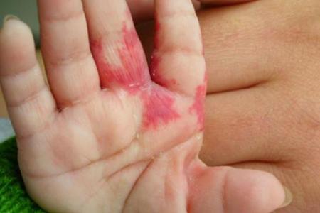 全面解析：胎记算命图解