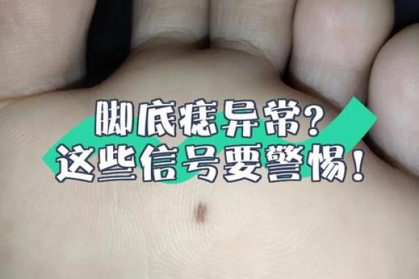 脚上胎记算命，脚底长胎记好不好