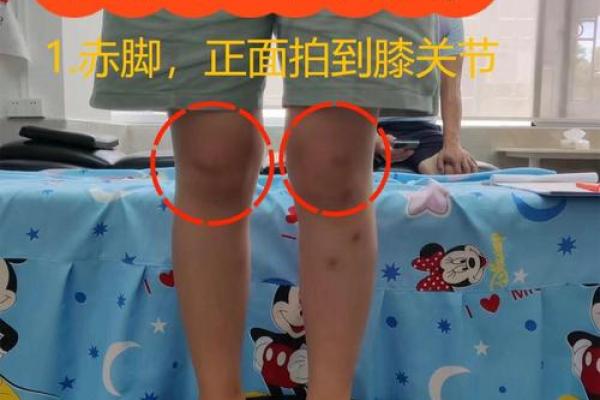 内八字、外八字孩子脚型正常不正常,家长可以这么判断 内八字、外八字孩子脚型正常不正常,家长可以这么判断