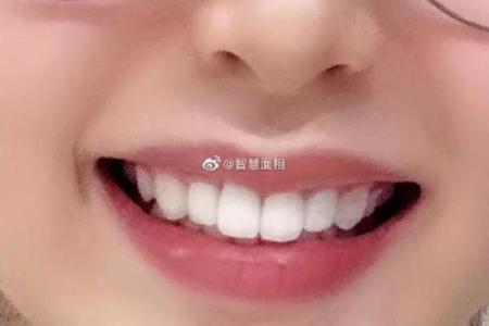 八字型门牙