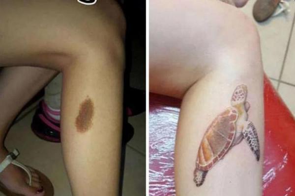 胳膊胎记算命 胳膊胎记算命