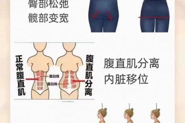 避免八字臀的危害，关爱您的健康