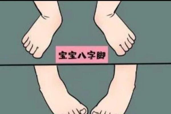 八字脚是什么 八字脚是什么