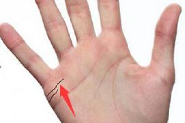 右眼睛下面长白毛算命 右眼睛下面长白毛算命