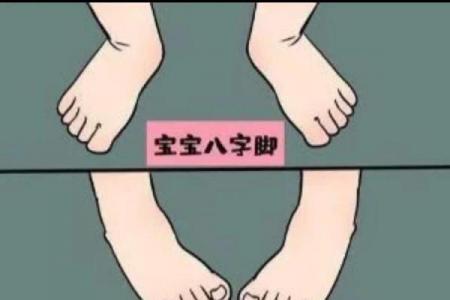 八字脚是什么