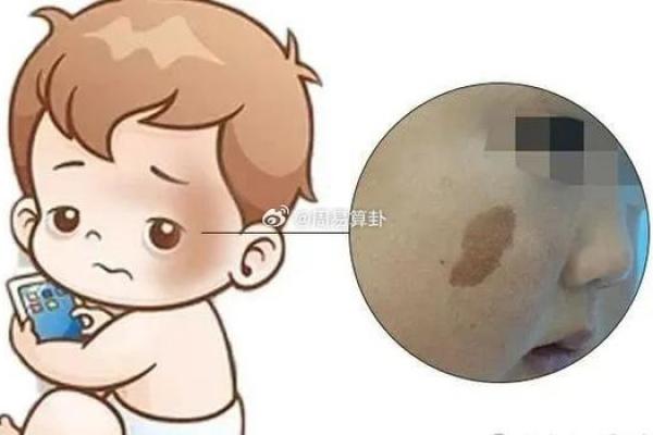 腿上不同位置的胎记算命