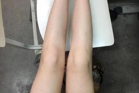 腿上不同位置的胎记算命