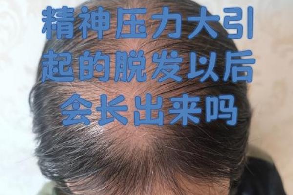 精神压力大的八字特征 八字精神压力大如何缓解